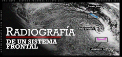 Radiografía de un sistema frontal